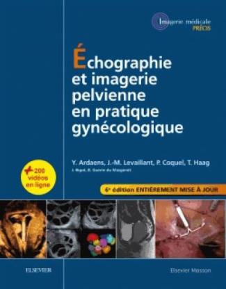 Echographie et imagerie pelvienne en pratique gynécologique. 6e édition