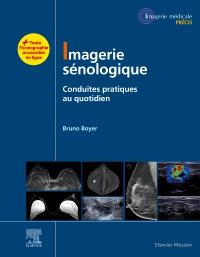 Imagerie sénologique. Conduites pratiques au quotidien