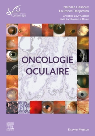 Oncologie oculaire. Edition 2022