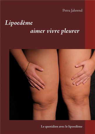 Le quotidien avec le lipoedème