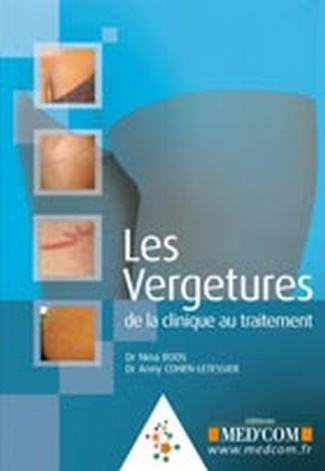 Les Vergetures