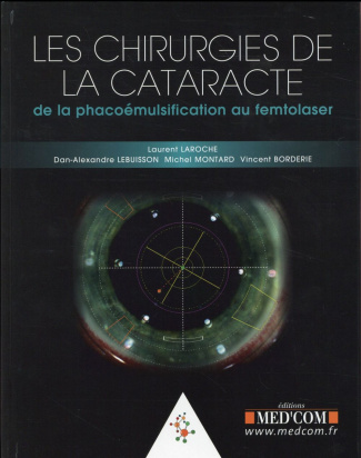 Les chirurgies de la cataracte. De la phacoémulsification au femtolaser