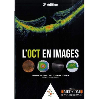 L'OCT en images. 2e édition