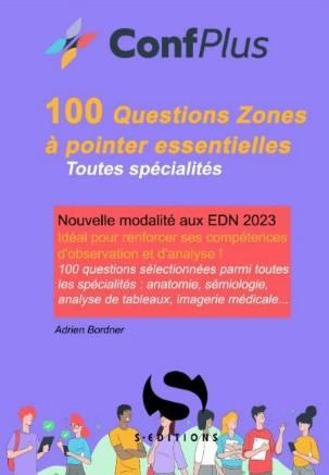100 Questions Zones à pointer indispensables