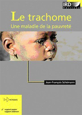 Le trachome. Une maladie de la pauvreté