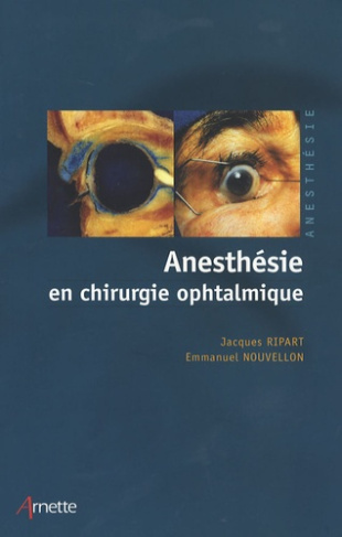 Anesthésie en chirurgie ophtalmique