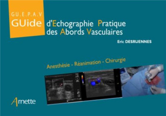 Guide d'échographie pratique des abords vasculaires (GU.E.P.A.V). Anesthésie - Réanimation - Chirurg