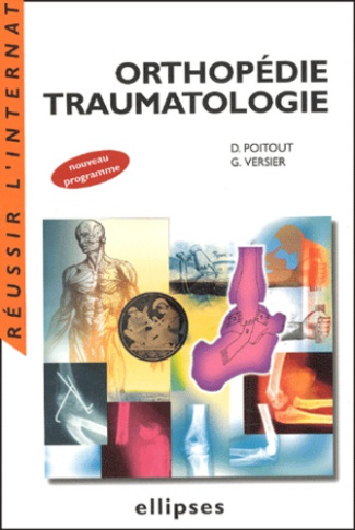 Orthopédie traumatologie