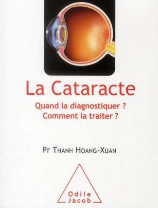 La cataracte. Quand la diagnostiquer ? Comment la traiter ?
