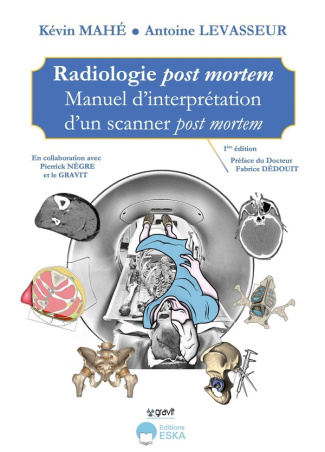 Radiologie post mortem. Manuel d'interprétation d'un scanner post mortem