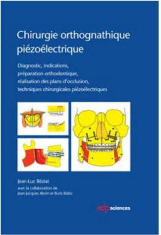 Chirurgie orthognatique piézoélectrique. Diagnostic, indications, préparation orthodontique, réalisa