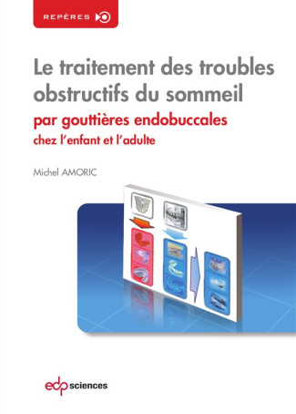 Le traitement des troubles obstructifs du sommeil par gouttières endobuccales chez l'enfant et l'adu