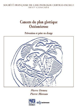 Les cancers du plan glottique. L'ostéoradionécrose : prévention et prise en charge