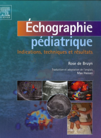Echographie pédiatrique. Indications, techniques et résultats