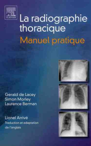 Radiographie thoracique. Manuel pratique