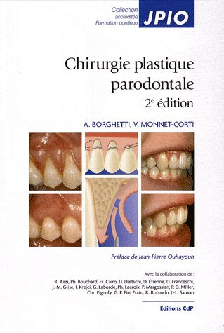 CHIRURGIE PLASTIQUE PARODONTALE 2EME EDITION