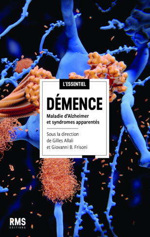 Démence. Maladie d'Alzheimer et syndromes apparentés