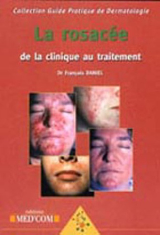 La Rosacée. De la clinique au traitement