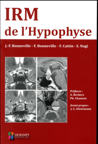 Bonneville_Jean-Fran_ois_Bonneville_Fabrice_Ca-IRM_de_l_hypophyse-9791030301281_0