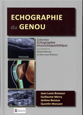 Brasseur_Jean-Louis_Mercy_Guillaume_Renoux_J_r-Echographie_du_genou-9791030302097_0