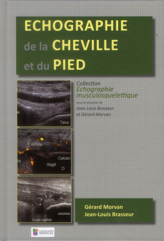 Brasseur_Jean-Louis_Morvan_G_rard-Echographie_de_la_cheville_et_du_pied-9782840238584_0