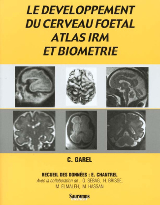 Brisse_Herv_Elmaleh_M_Garel_C_Hassan_M_Se-Le_d_veloppement_du_cerveau_foetal_Atlas_IRM_et_biom_trie-9782840232452_0