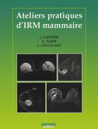 Chopier_J_Taieb_S_Ceugnart_Luc-Ateliers_Pratiques_d_IRM_Mammaire-9782840235217_0