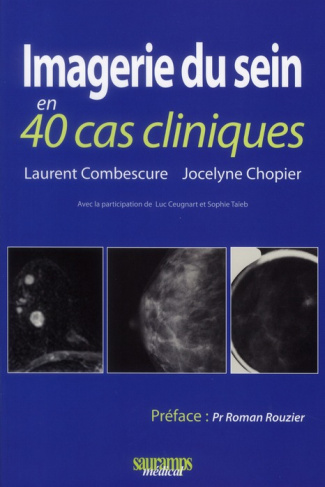 Combescure_Laurent_Chopier_Jocelyne_Ceugnart_L-Imagerie_du_sein_en_40_cas_cliniques-9782840237235_0