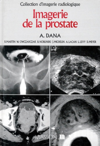 DANA-IMAGERIE_DE_LA_PROSTATE-9782225843259_0
