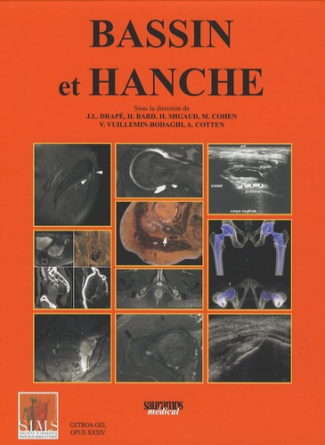 Drap_Jean-Luc_Bard_Herv_Migaud_Hugues_Cohe-Bassin_et_hanche._Congr_s_th_matique_de_juin-9782840235125_0