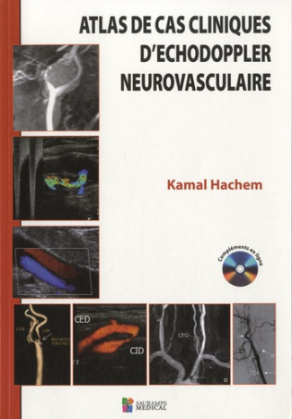 Hachem_Kamal_Braidy_Chadi_Kheir_Costy_Slaba-Atlas_des_cas_cliniques_d_chodoppler_neurovasculaire-9782840236870_0