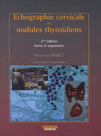 Marcy_Pierre-Yves-Echographie_cervicale_et_nodules_thyro_diens._2e_dition_revue_et_augment_e-9782840233947_0