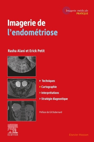 alani-rasha-petit-erick-imagerie-de-l-endometriose_0