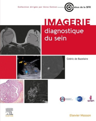de-bazelaire-cedric-imagerie-diagnostique-du-sein_0