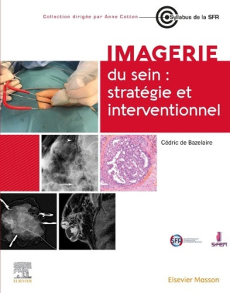 de-bazelaire-cedric-imagerie-du-sein-strategie-et-interventionnel_0