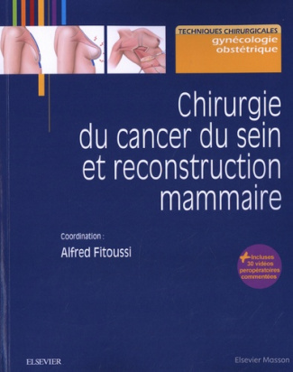 fitoussi-alfred-chirurgie-du-cancer-du-sein-et-reconstruction-mammaire-pod_0