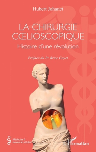 la-chirurgie-coelioscopique-histoire-d-une-revolution_0