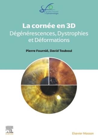 la-cornee-en-3d-degenerescences-dystrophies-et-deformations_0