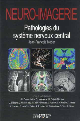 neuro-imagerie-pathologies-du-systeme-nerveux-central-2ed_0