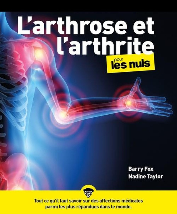 L'arthrose et l'arthrite pour les Nuls