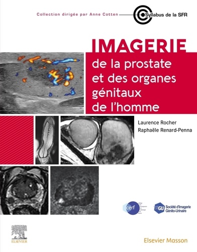 Imagerie de la prostate et des organes génitaux de l'homme